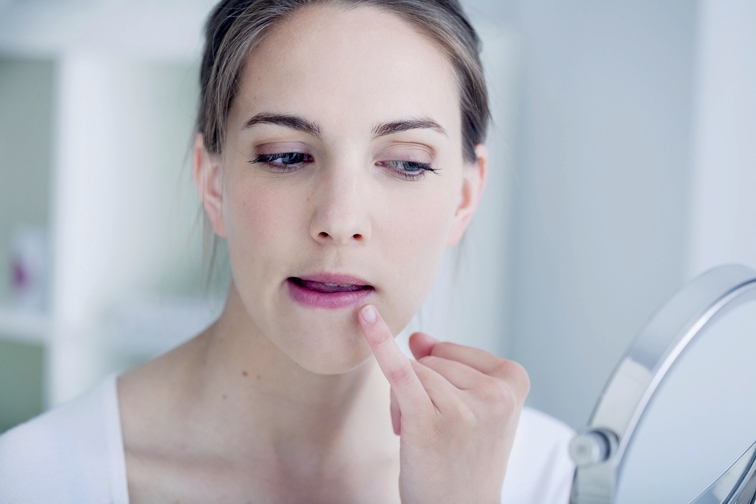 Lippenherpes: Warum es brennt, und was hilft